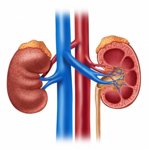 Can a Plant-Based Diet Prevent/Treat Kidney Stones?