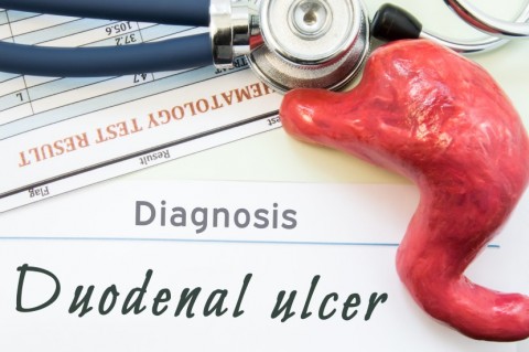 Duodenal Ulcer Diagnosis