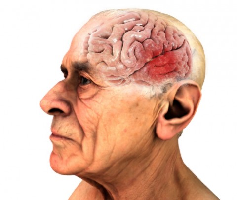 Old Man With Damaged Brain