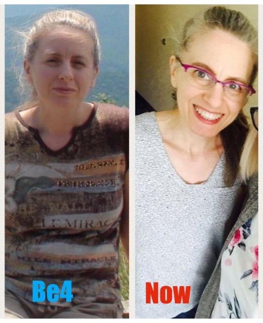 From Survive to Thrive: Patty's Cancer Journey